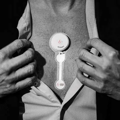 ECG247 Cardiac Rhythm Monitoring